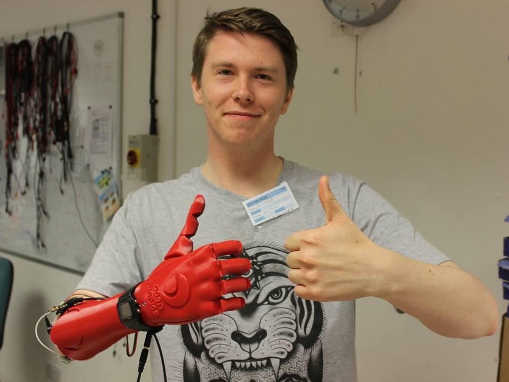 Врач делающий протезы. Open Bionics протезы. 3д бионического протеза. Open Bionics протезы рук.
